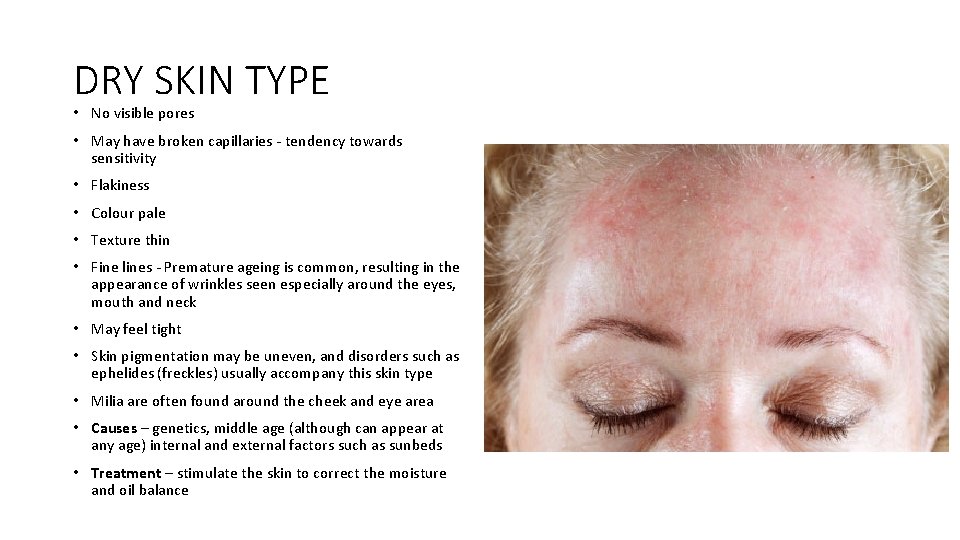 DRY SKIN TYPE • No visible pores • May have broken capillaries - tendency