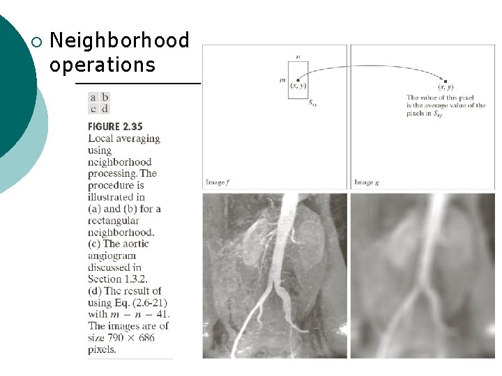 ¡ Neighborhood operations 