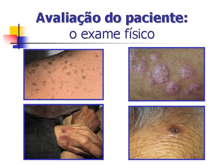 Avaliação do paciente: o exame físico Avaliação do paciente: o exame físico