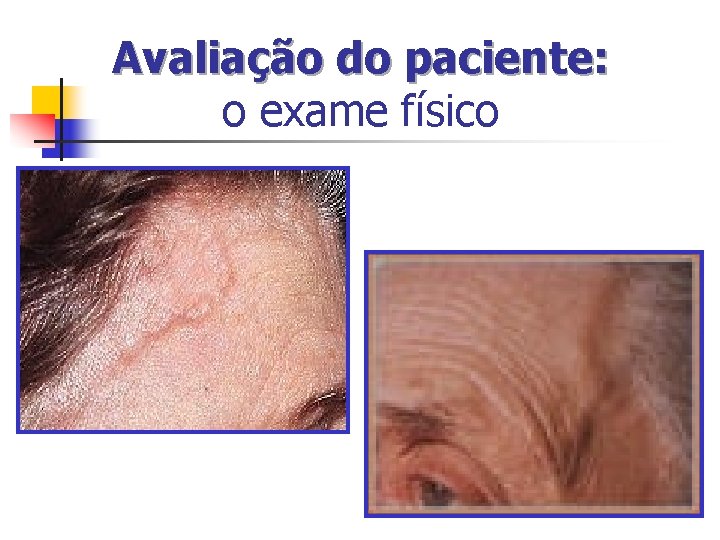 Avaliação do paciente: o exame físico Avaliação do paciente: o exame físico