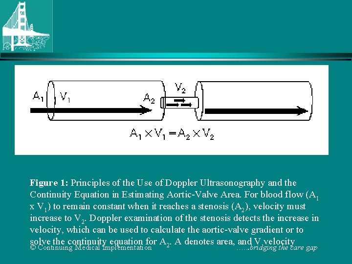 Figure 1: Principles of the Use of Doppler Ultrasonography and the Continuity Equation in