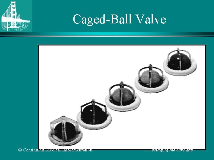 Caged-Ball Valve © Continuing Medical Implementation …. . . bridging the care gap 