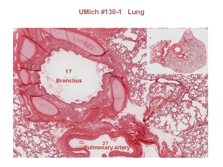 UMich #130 -1 Lung 1? Bronchus 2? Pulmonary artery 