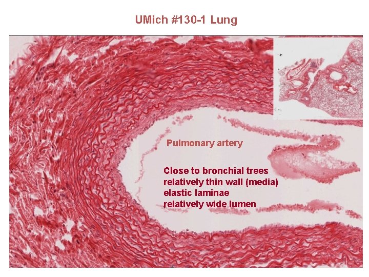 UMich #130 -1 Lung Pulmonary artery Close to bronchial trees relatively thin wall (media)