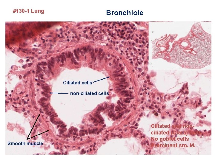 #130 -1 Lung Bronchiole Ciliated cells non-ciliated cells Smooth muscle Ciliated and nonciliated (Clara)