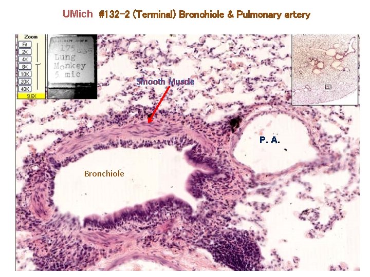 UMich #132 -2 (Terminal) Bronchiole & Pulmonary artery Smooth Muscle P. A. Bronchiole 