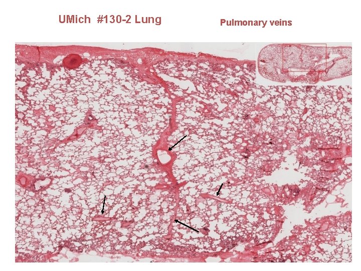 UMich #130 -2 Lung Pulmonary veins 