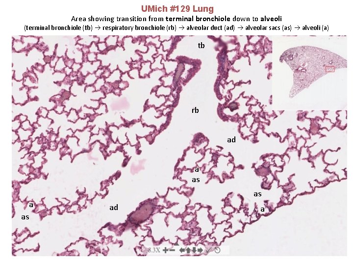 UMich #129 Lung Area showing transition from terminal bronchiole down to alveoli (terminal bronchiole