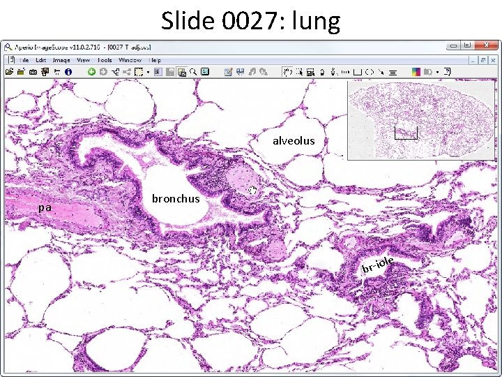 Slide 0027: lung alveolus pa bronchus le br-io 