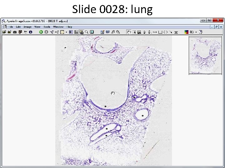 Slide 0028: lung * * * 