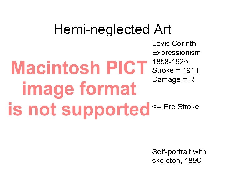 Hemi-neglected Art Lovis Corinth Expressionism 1858 -1925 Stroke = 1911 Damage = R <-- Hemi-neglected Art Lovis Corinth Expressionism 1858 -1925 Stroke = 1911 Damage = R <--