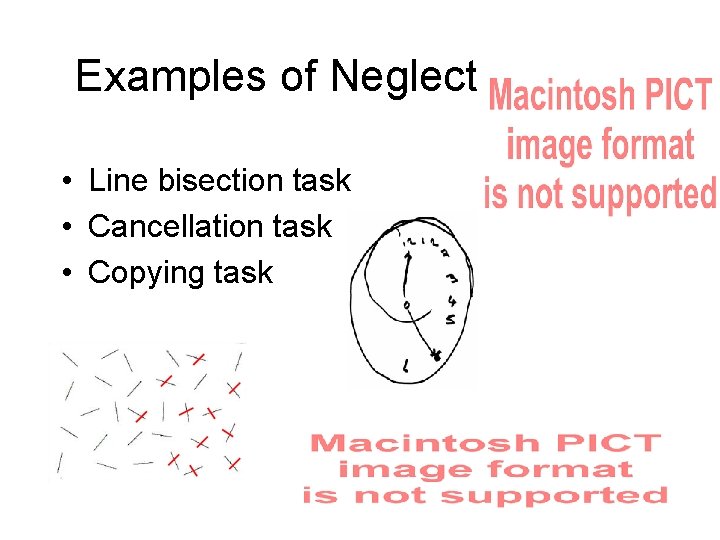 Examples of Neglect • Line bisection task • Cancellation task • Copying task Examples of Neglect • Line bisection task • Cancellation task • Copying task