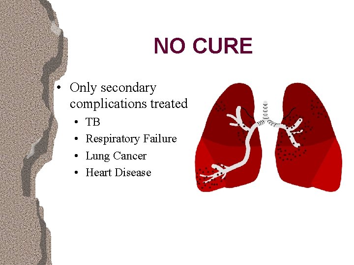 NO CURE • Only secondary complications treated • • TB Respiratory Failure Lung Cancer