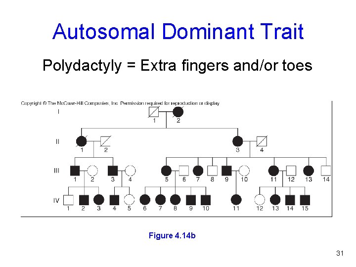 Autosomal Dominant Trait Polydactyly = Extra fingers and/or toes Figure 4. 14 b 31
