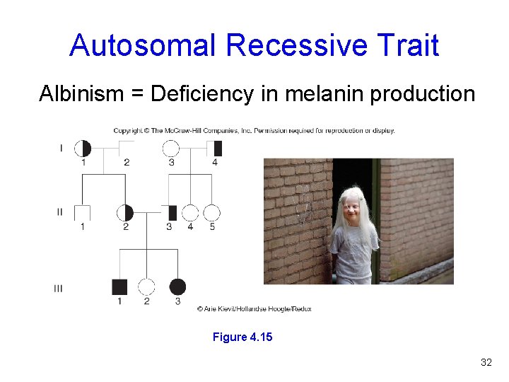Autosomal Recessive Trait Albinism = Deficiency in melanin production Figure 4. 15 32 