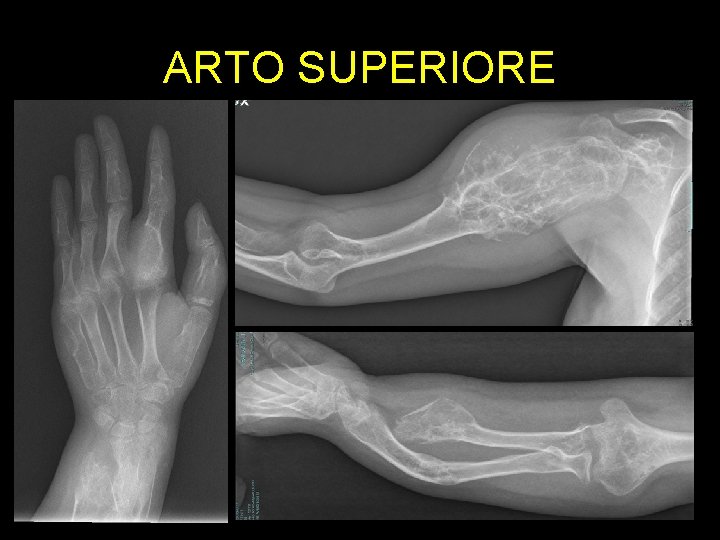 ARTO SUPERIORE ARTO SUPERIORE
