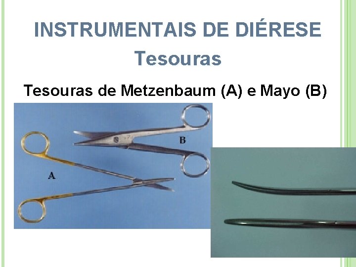 INSTRUMENTAIS DE DIÉRESE Tesouras de Metzenbaum (A) e Mayo (B) 