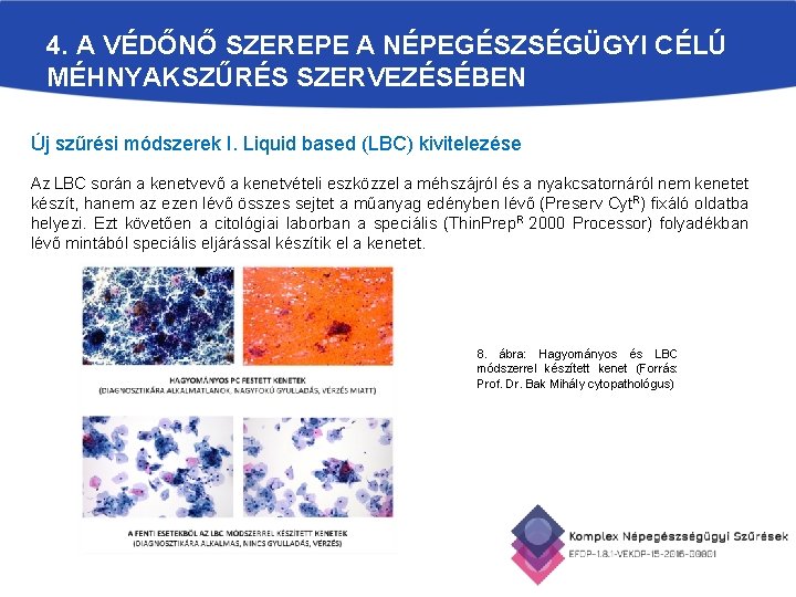 4. A VÉDŐNŐ SZEREPE A NÉPEGÉSZSÉGÜGYI CÉLÚ MÉHNYAKSZŰRÉS SZERVEZÉSÉBEN Új szűrési módszerek I. Liquid