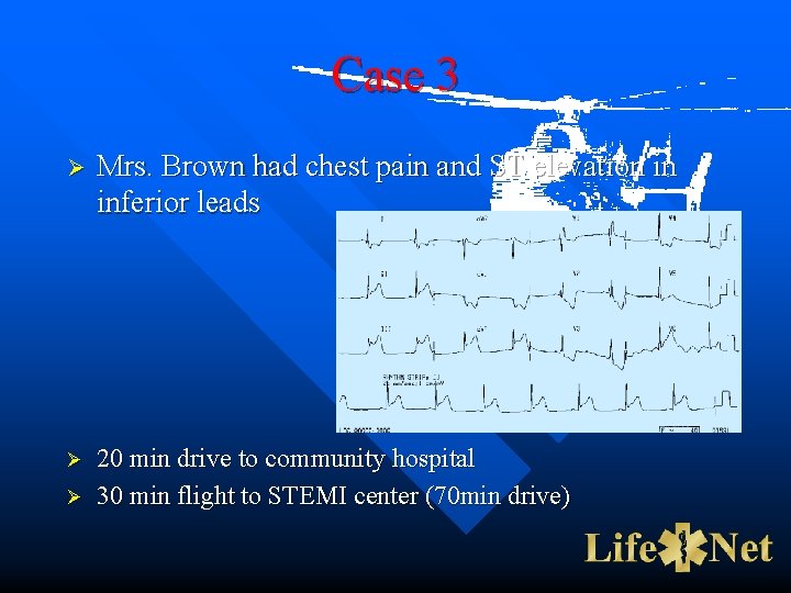 Case 3 Ø Mrs. Brown had chest pain and ST elevation in inferior leads