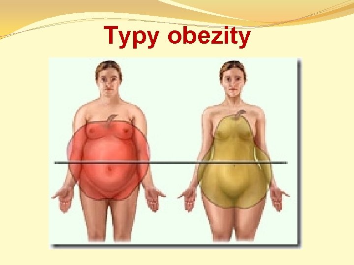 Typy obezity 