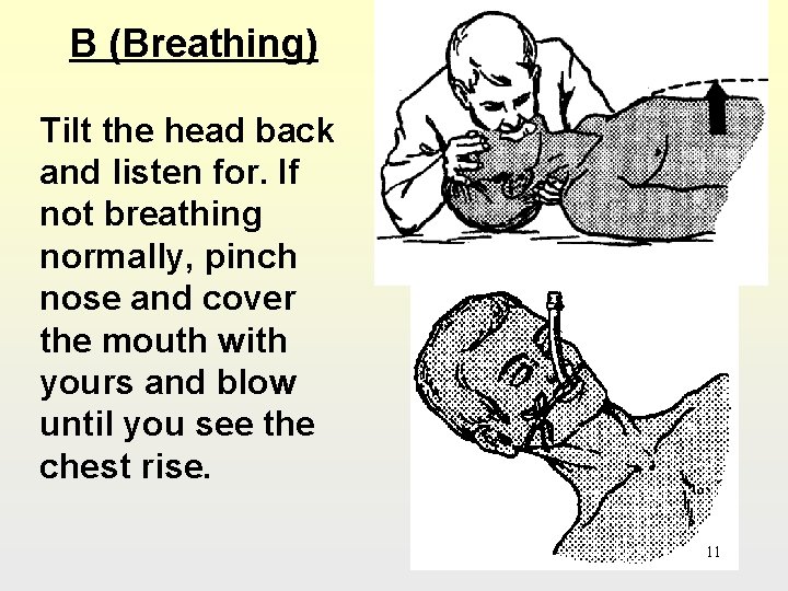 B (Breathing) Tilt the head back and listen for. If not breathing normally, pinch