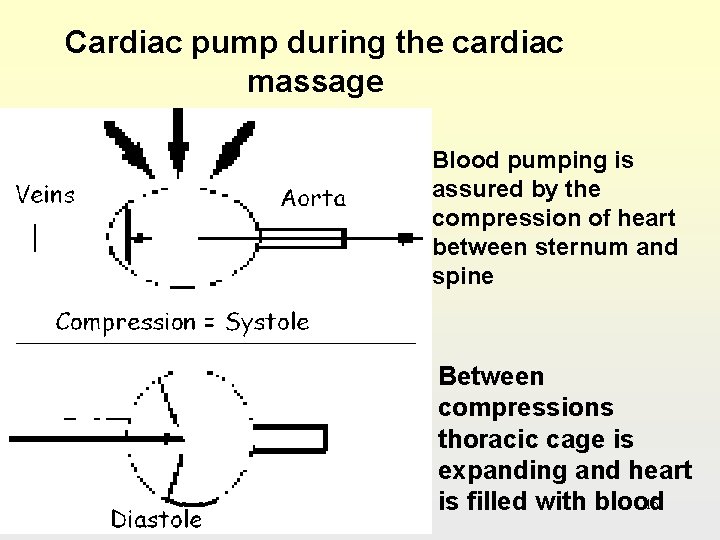 Cardiac pump during the cardiac massage Blood pumping is assured by the compression of