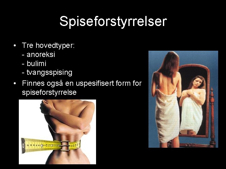 Spiseforstyrrelser • Tre hovedtyper: - anoreksi - bulimi - tvangsspising • Finnes også en