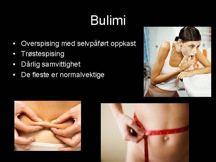 Bulimi • • Overspising med selvpåført oppkast Trøstespising Dårlig samvittighet De fleste er normalvektige