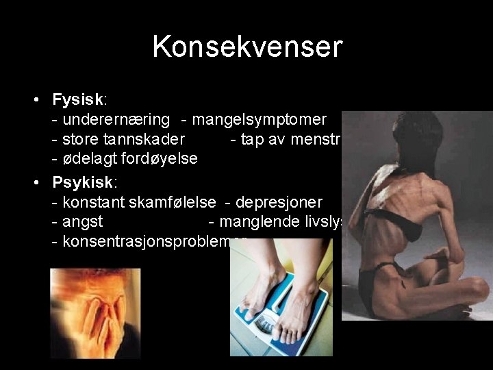 Konsekvenser • Fysisk: - underernæring - mangelsymptomer - store tannskader - tap av menstruasjon