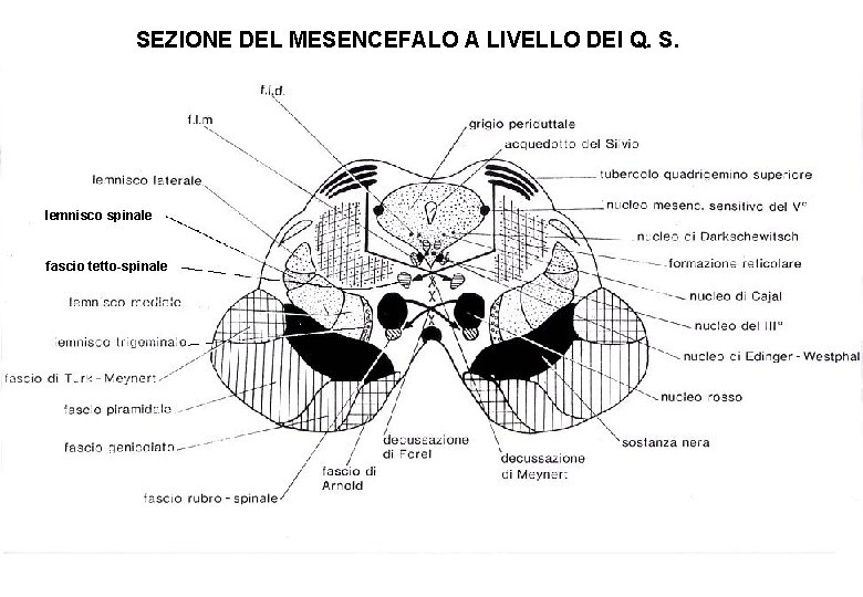 SEZIONE DEL MESENCEFALO A LIVELLO DEI Q. S. lemnisco spinale fascio tetto-spinale 