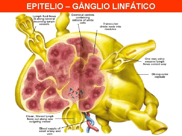 EPITELIO – G NGLIO LINFÁTICO 