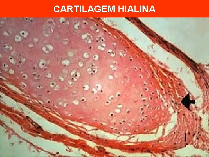 CARTILAGEM HIALINA 