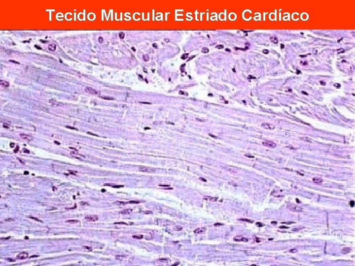 Tecido Muscular Estriado Cardíaco 