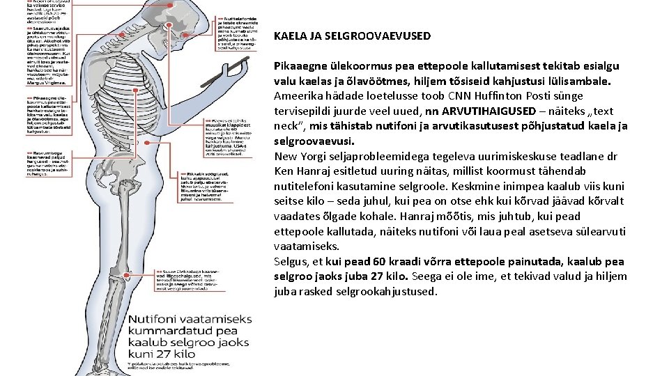 KAELA JA SELGROOVAEVUSED Pikaaegne ülekoormus pea ettepoole kallutamisest tekitab esialgu valu kaelas ja õlavöötmes,