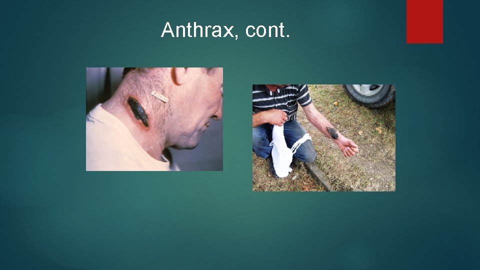 Anthrax, cont. 