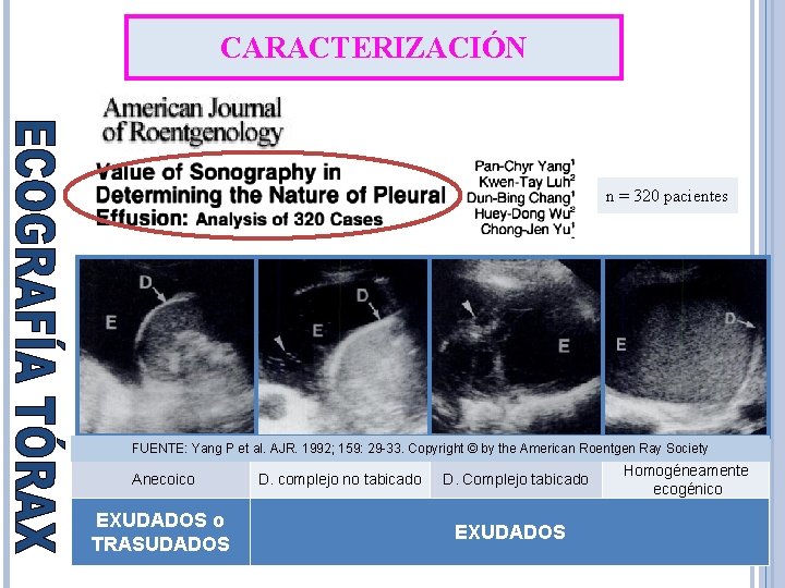 CARACTERIZACIÓN n = 320 pacientes FUENTE: Yang P et al. AJR. 1992; 159: 29