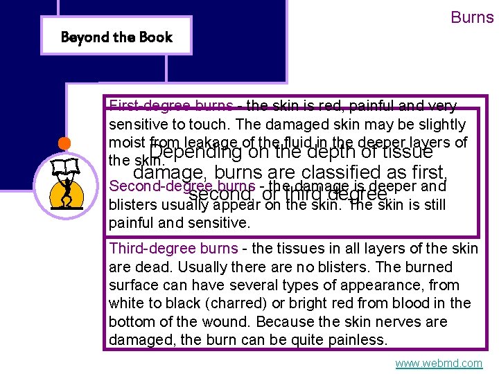 Burns Beyond the Book First-degree burns - the skin is red, painful and very