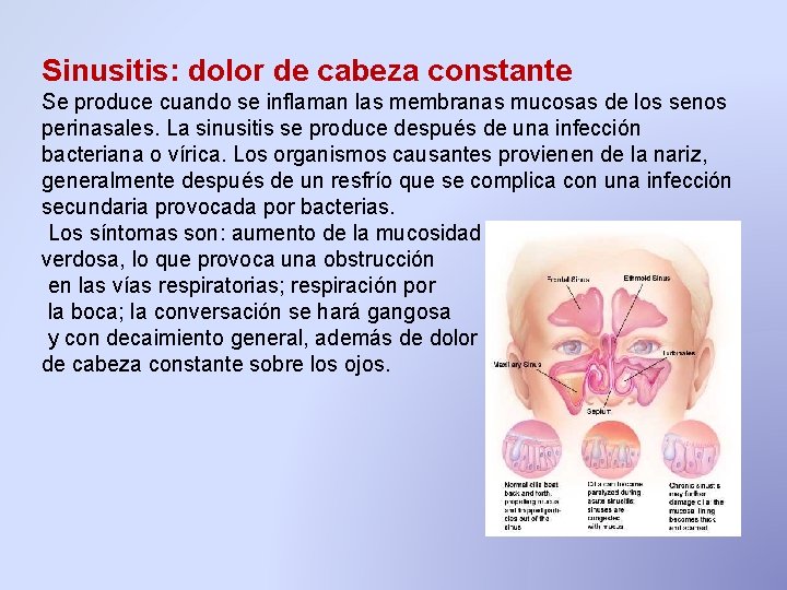 Sinusitis: dolor de cabeza constante Se produce cuando se inflaman las membranas mucosas de Sinusitis: dolor de cabeza constante Se produce cuando se inflaman las membranas mucosas de