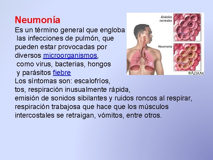 Neumonía Es un término general que engloba las infecciones de pulmón, que pueden estar Neumonía Es un término general que engloba las infecciones de pulmón, que pueden estar