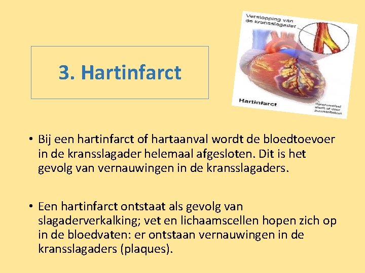 3. Hartinfarct • Bij een hartinfarct of hartaanval wordt de bloedtoevoer in de kransslagader