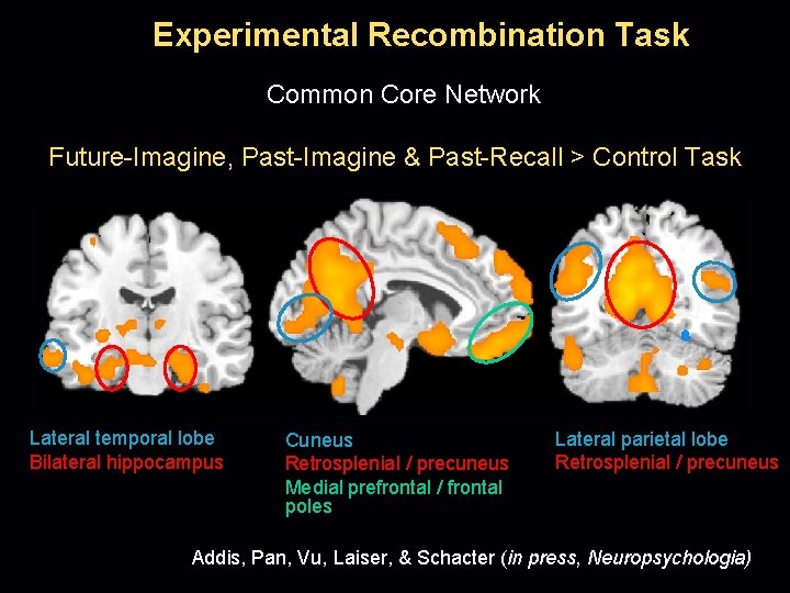 Experimental Recombination Task Common Core Network Future-Imagine, Past-Imagine & Past-Recall > Control Task Lateral