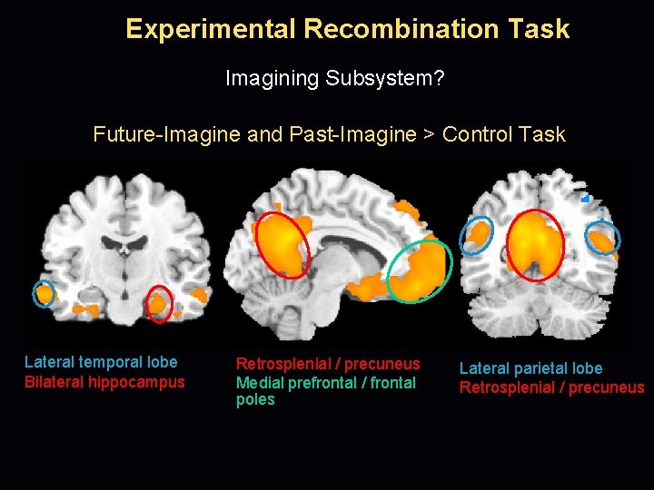 Experimental Recombination Task Imagining Subsystem? Future-Imagine and Past-Imagine > Control Task Lateral temporal lobe