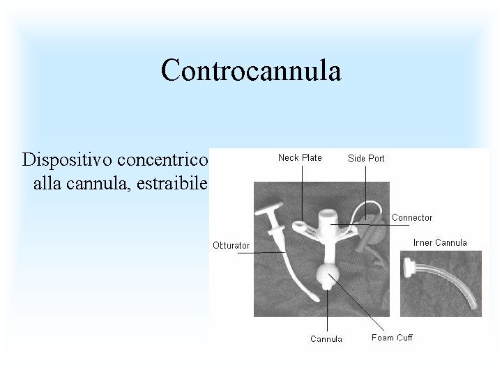 Controcannula Dispositivo concentrico alla cannula, estraibile. 