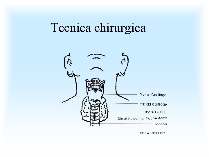 Tecnica chirurgica 