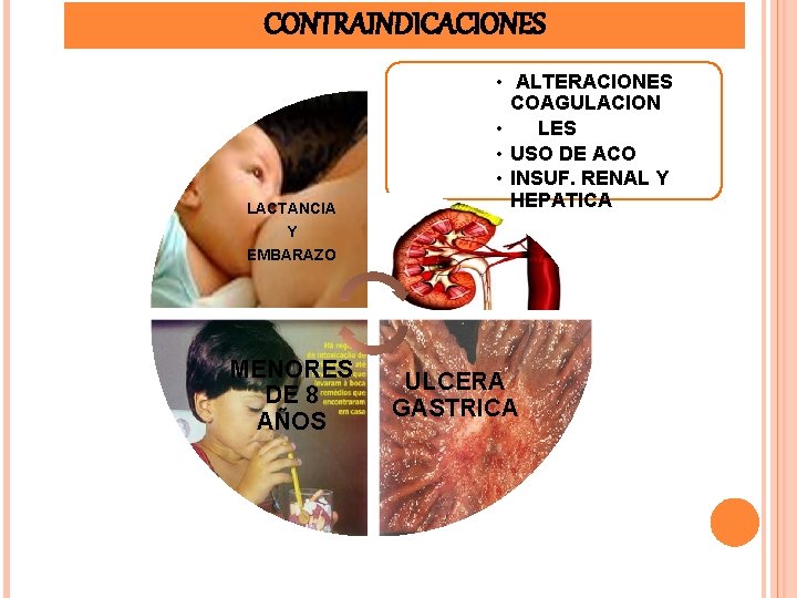 CONTRAINDICACIONES LACTANCIA Y EMBARAZO MENORES DE 8 AÑOS • ALTERACIONES COAGULACION • LES •