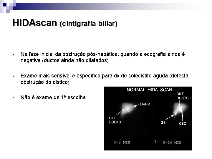 HIDAscan (cintigrafia biliar) • Na fase inicial da obstrução pós-hepática, quando a ecografia ainda