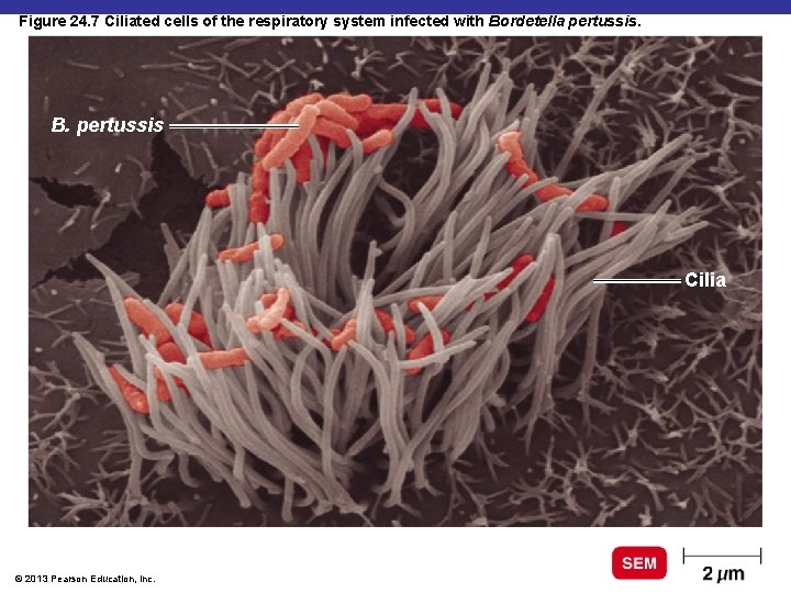 Figure 24. 7 Ciliated cells of the respiratory system infected with Bordetella pertussis. B.