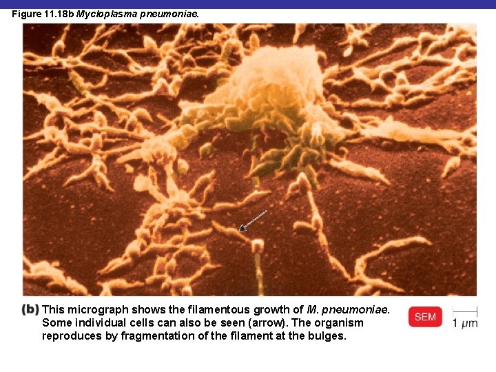 Figure 11. 18 b Mycloplasma pneumoniae. This micrograph shows the filamentous growth of M.