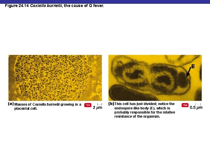 Figure 24. 14 Coxiella burnetii, the cause of Q fever. E Masses of Coxiella