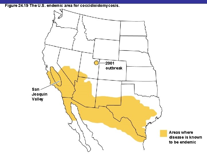 Figure 24. 19 The U. S. endemic area for coccidioidomycosis. 2001 outbreak San Joaquin